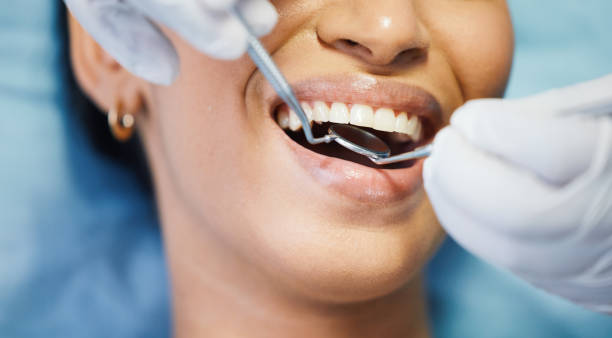 Best Emergency Cosmetic Dentistry in New Chicago, IN