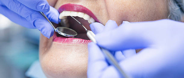 Best Broken or Cracked Tooth Emergency Dentist in New Chicago, IN